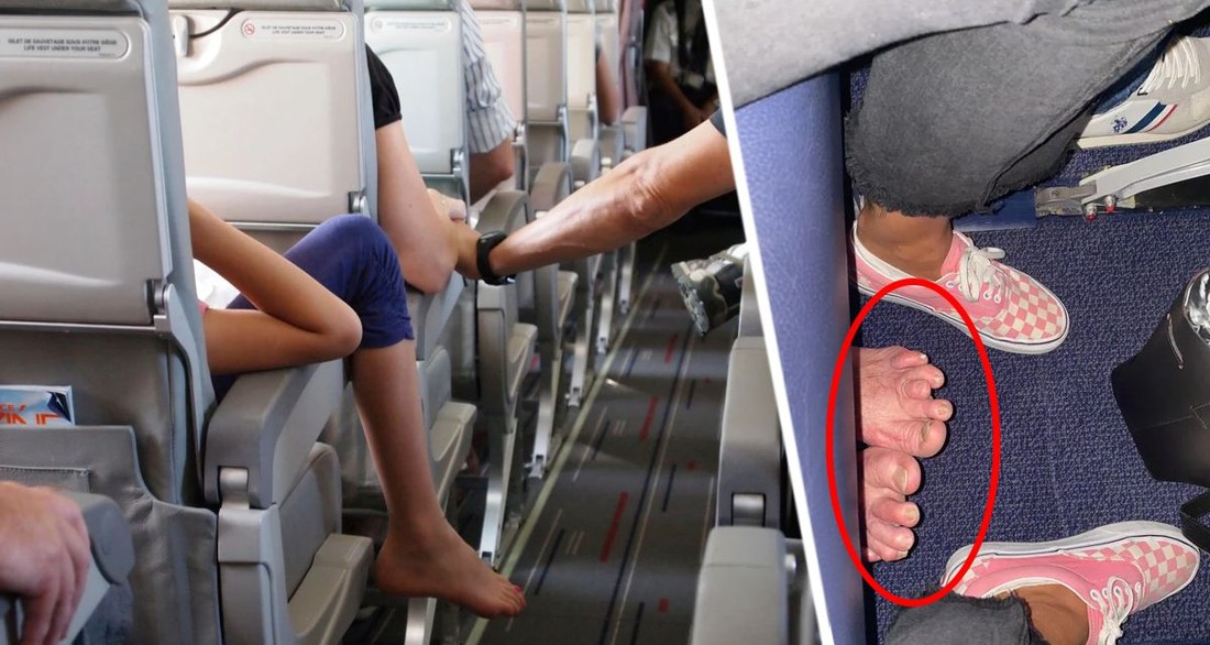 Турист был ошеломлен, увидев под собой в самолете изъеденные грибком ноги попутчика