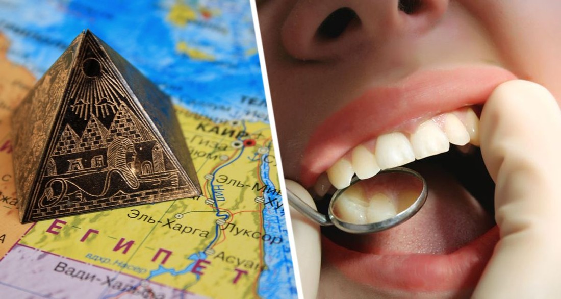 All Inclusive обратился в зубной ад: российская туристка рассказала, как в Египте зуб лечили